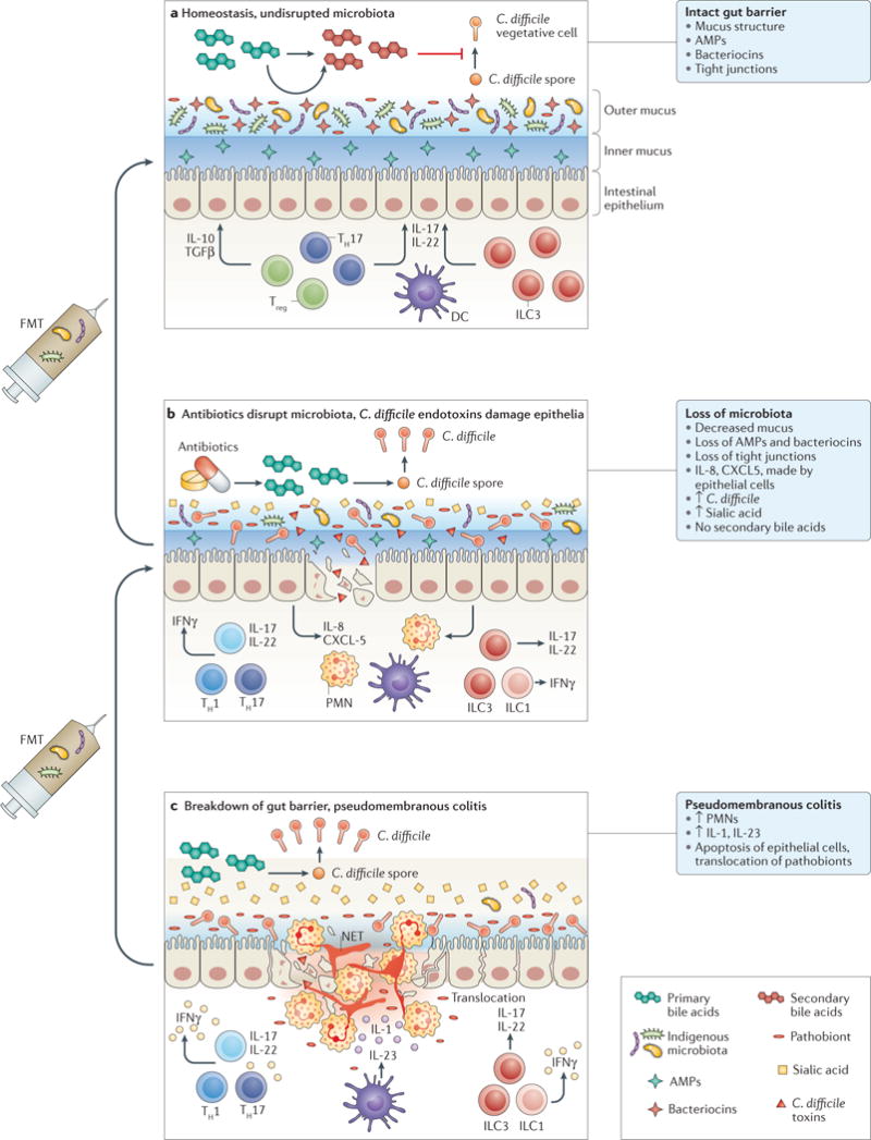 Trapianto di microbiota